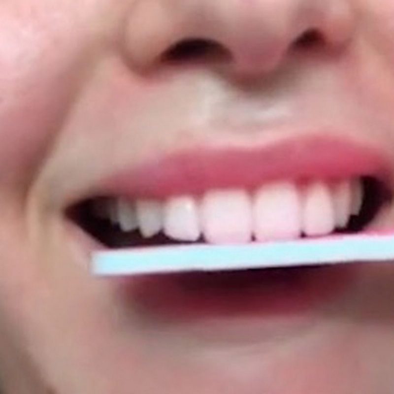 Dentists Warns The Molar Makeover TikTok Challenge