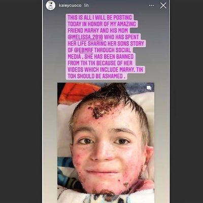 TikTok Ban Young Disabled Wichitan Account, Restored After Slam TikTok Death