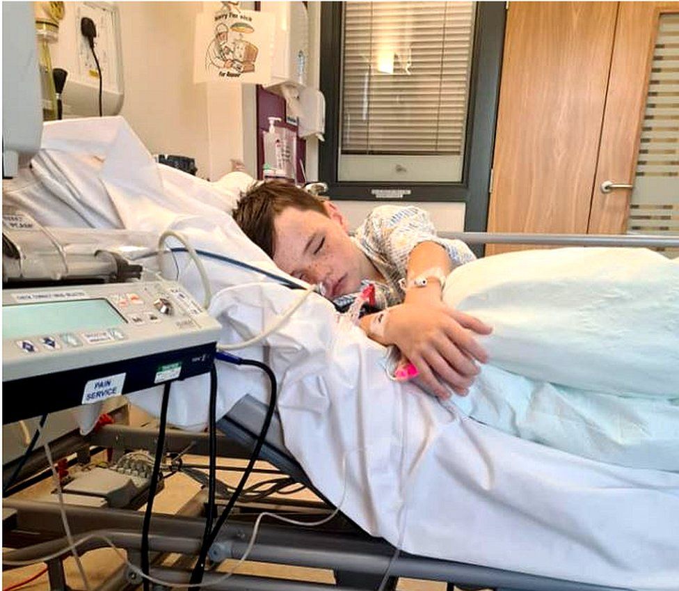 Boy Faced Abdominal Surgery After Swallowing Magnets For TikTok Challenge TikTok Death
