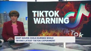 Boy 12, Badly Burned Performing TikTok Challenge TikTok Death