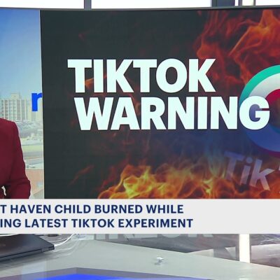Boy 12, Badly Burned Performing TikTok Challenge TikTok Death